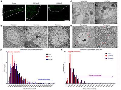 Corrigendum: Ultrastructural characteristics of neuronal death and white matter injury in mouse brain tissues after intracerebral hemorrhage: coexistence of ferroptosis, autophagy, and necrosis